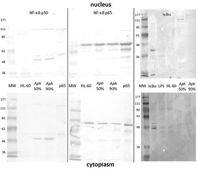 Anaplasma phagocytophilum Activates NF-κB Signaling via Redundant Pathways